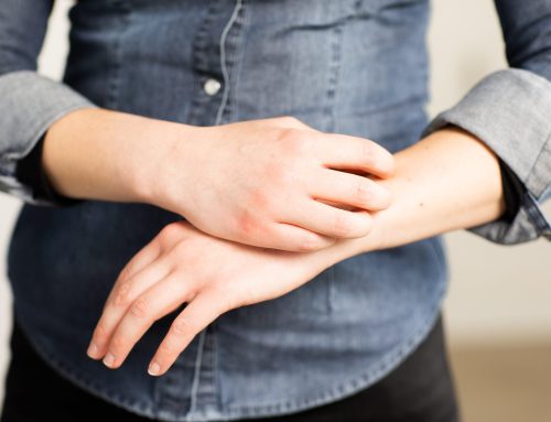Today it is World Atopic Eczema Day