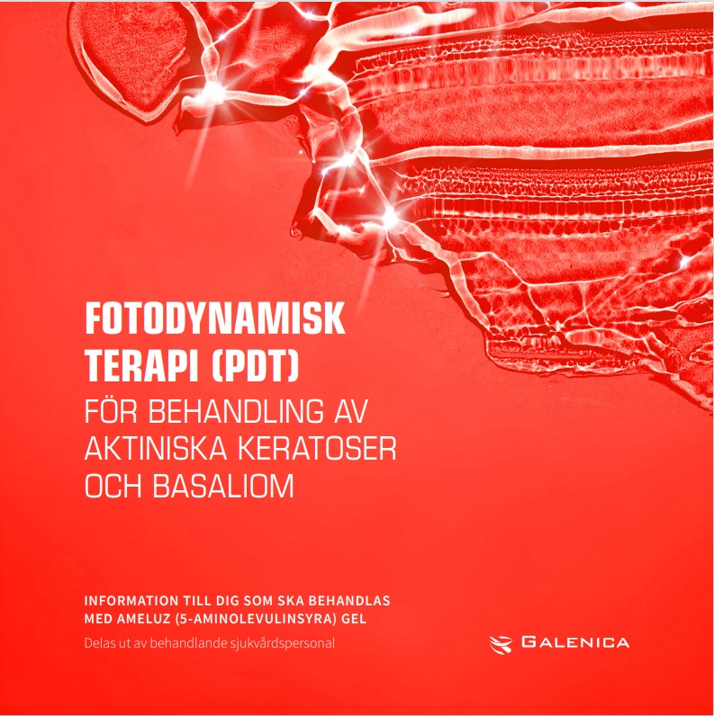 PDT med Lampa SE
